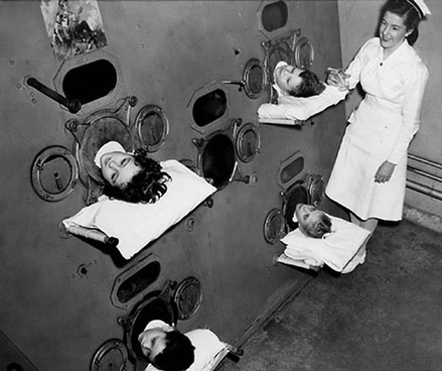 ריאות ברזל - מכונות הנשמה ששימשו לחולי פוליו - רבים מהם ילדים - לפני שפותח החיסון. חלקם שרדו חודשים בתוך המכונות הללו כשרק ראשם מבצבץ החוצה. שנת 1937