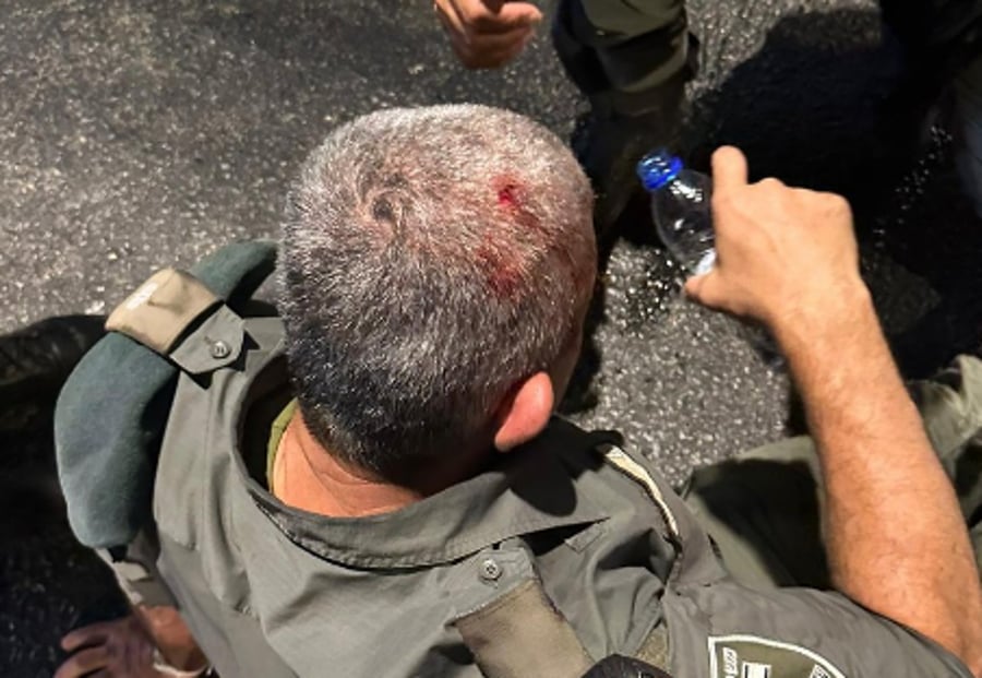 שוטר שנפצע בהפגנת צדק לרפאל