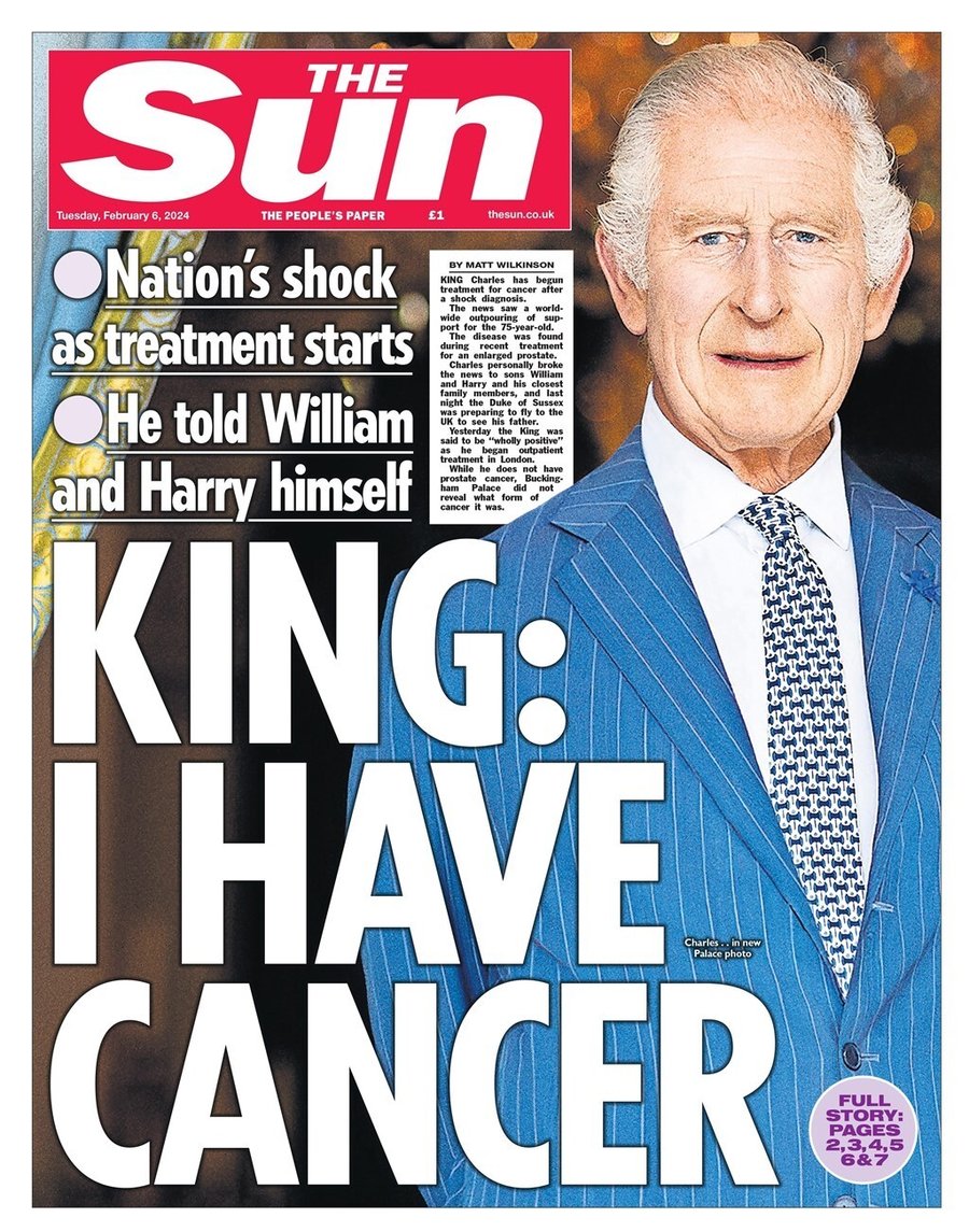 כותרות העיתונים בממלכה ביום שאחרי: "למלך יש סרטן"  