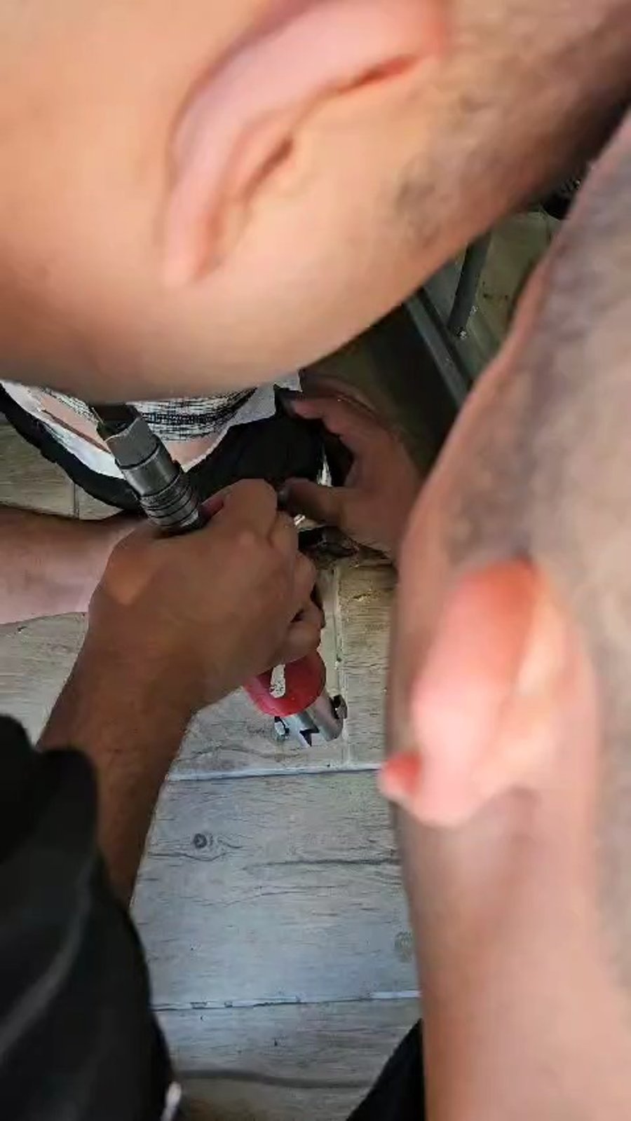 חילוץ רגלו של הפעוט