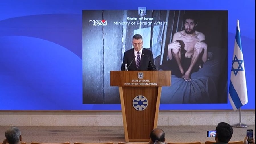 דבריו של סער | צפו