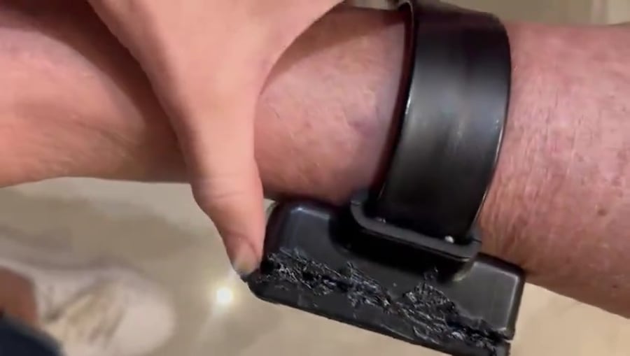 האזיק שהנשיא ניסה להלחים